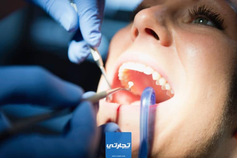 قائمة أسعار علاج الأسنان في تركيا 2023