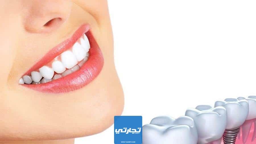 مميزات زراعة الأسنان الفورية في تركيا